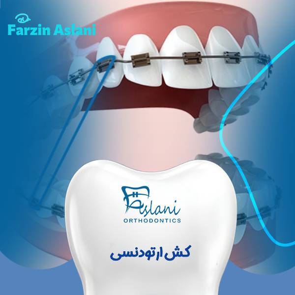 الاستیک ارتودنسی