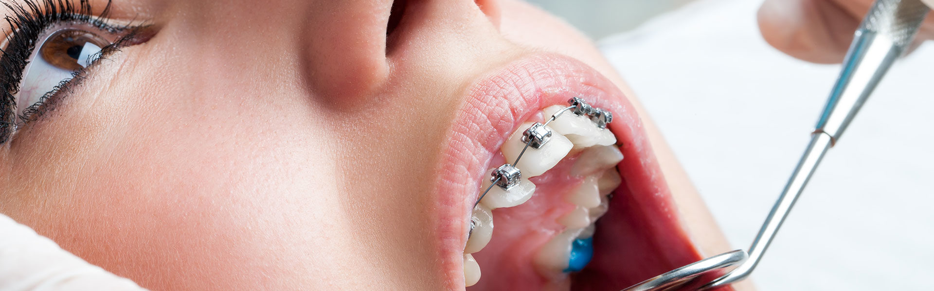what is an orthodontist 1920x600 - آيا فوق تخصص ارتودنسى وجود دارد؟