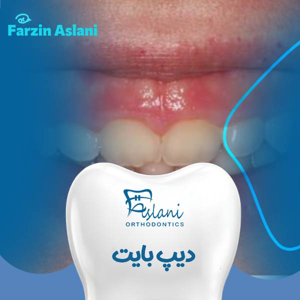 عکس ذیپ بایت