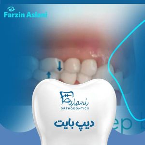 عکس دیپ بایت
