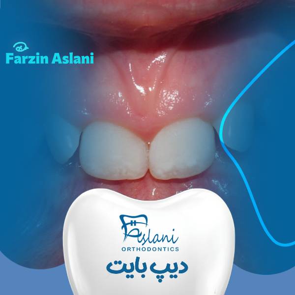 عکس دیپ بایت