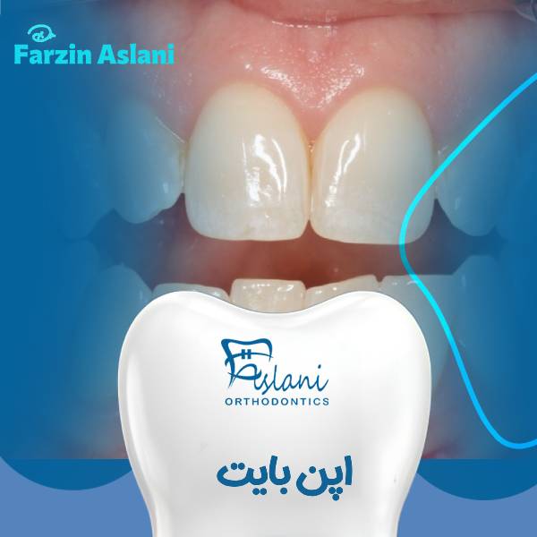 اپن بایت