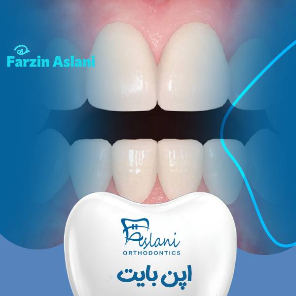 اپن بایت
