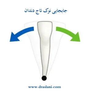 حرکت دندان در ارتودنسی _ دکتر فرزین اصلانی