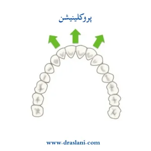 حرکت دندان ها در ارتودنسی _ دکتر فرزین اصلانی