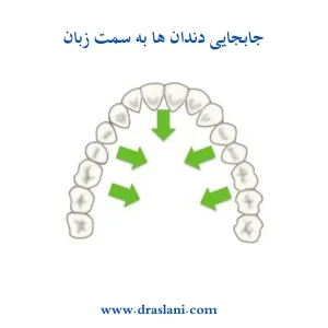 جابه جایی دندان ها در ارتودنسی _ دکتر فرزین اصلانی