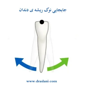 حرکت ریشه دندان در ارتودنسی _ دکتر فرزین اصلانی