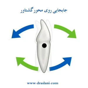 جابه جایی دندان ها در ارتودنسی _ دکتر فرزین اصلانی
