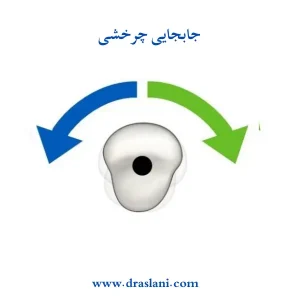 حرکت دندان ها در ارتودنسی _ دکتر فرزین اصلانی