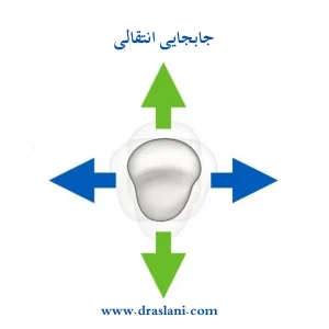 حرکت دندان در ارتودنسی _ دکتر فرزین اصلانی