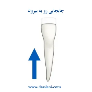 جابه جایی دندان ها در ارتودنسی _ دکتر فرزین اصلانی