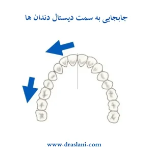 حرکات دندان در ارتودنسی _ دکتر فرزین اصلانی