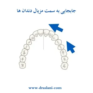 حرکت دندان در ارتودنسی _ دکتر فرزین اصلانی