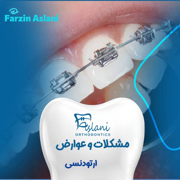 مشکلات و عوارض ارتودنسی