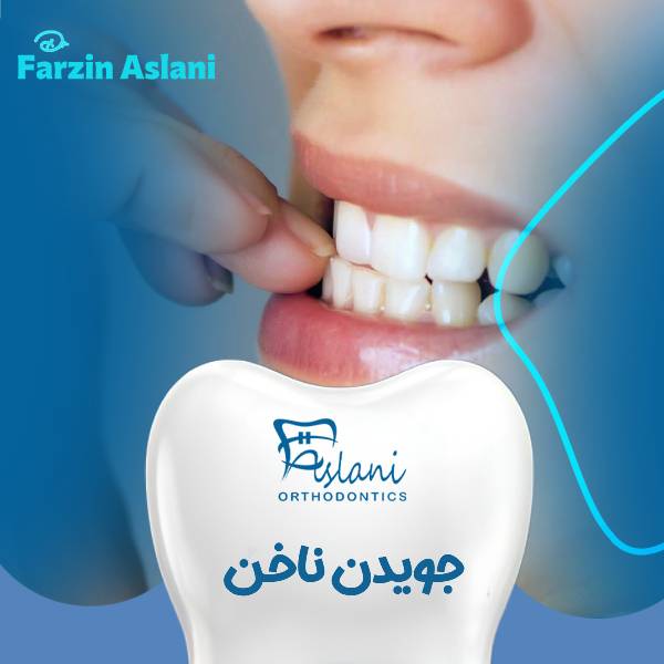جویدن ناخن