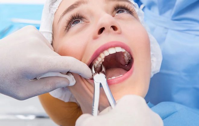0 1 660x420 - آیا کشیدن دندان عقل طی درمان ارتودنسی ضروری است؟
