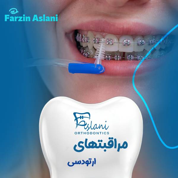 مراقبت های ارتودنسی