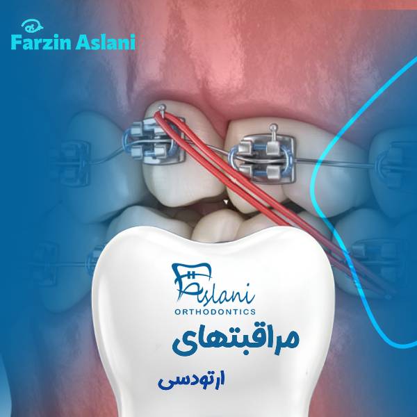 نکات هفته اول ارتودنسی