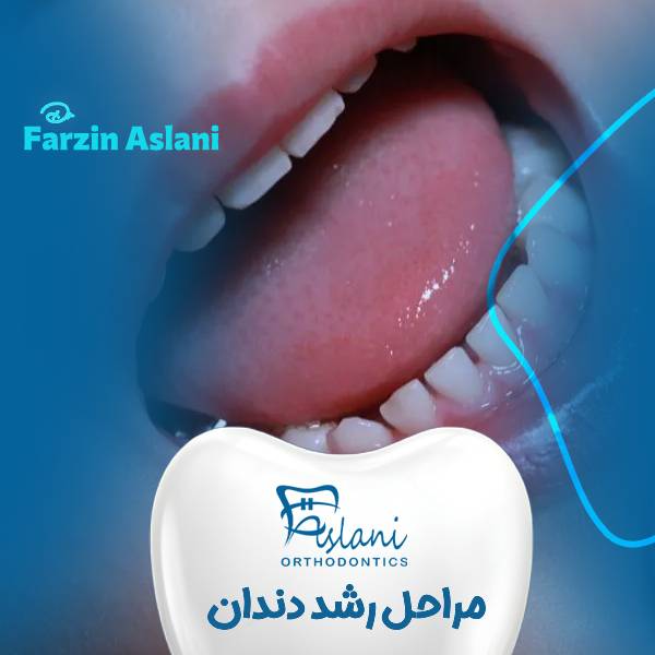 مراحل رشد دندان