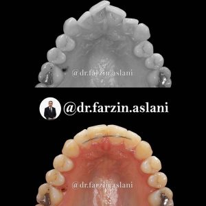 ارتودنسی ثابت _ دکتر فرزین اصلانی