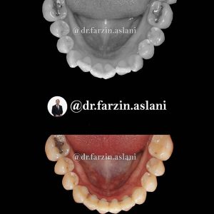 ارتودنسی ثابت _ دکتر فرزین اصلانی