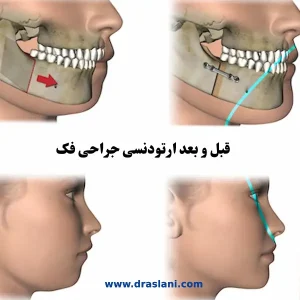 عکس اروتوسرجری _ دکتر فرزین اصلانی