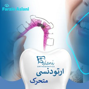 ارتودنسی متحرک در تهران _ دکتر فرزین اصلانی