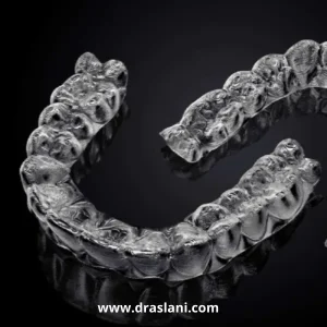 زمان درمان ارتودنسی نامریی _ دکتر فرزین اصلانی