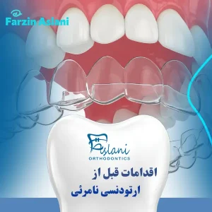 اقدامات قبل از ارتودنسی نامرئی _ دکتر فرزین اصلانی