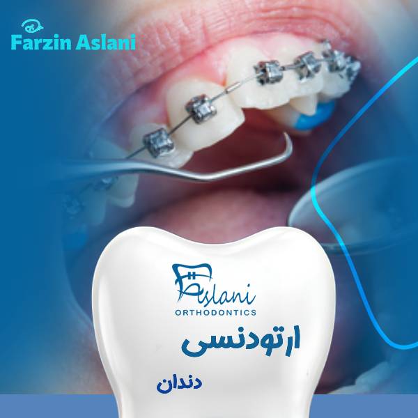 ارتودنسی دندان