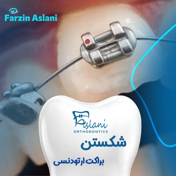 شکستن براکت ارتودنسی
