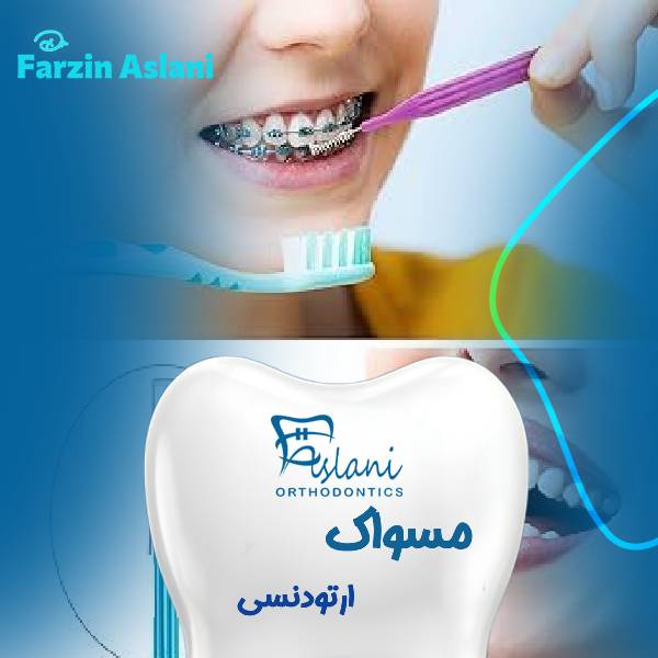 مسواک ارتودنسی