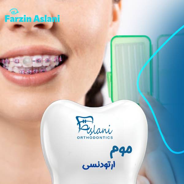 عکس موم ارتودنسی