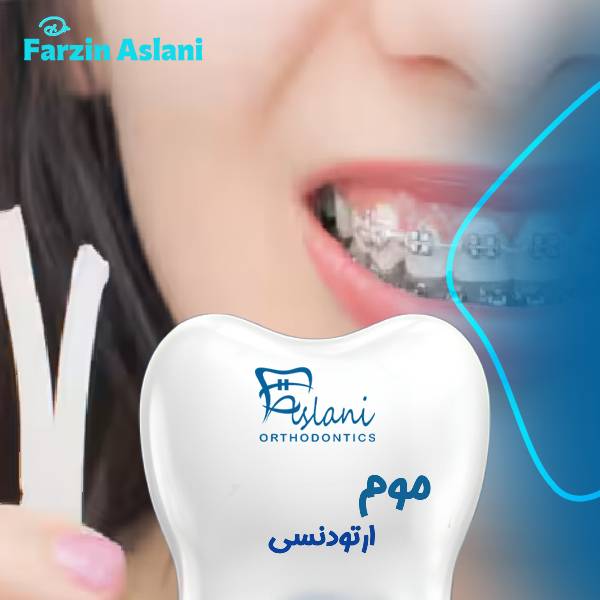 موم ارتودنسی