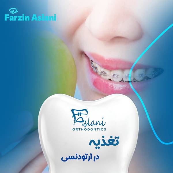 تغذیه در دوران ارتودنسی