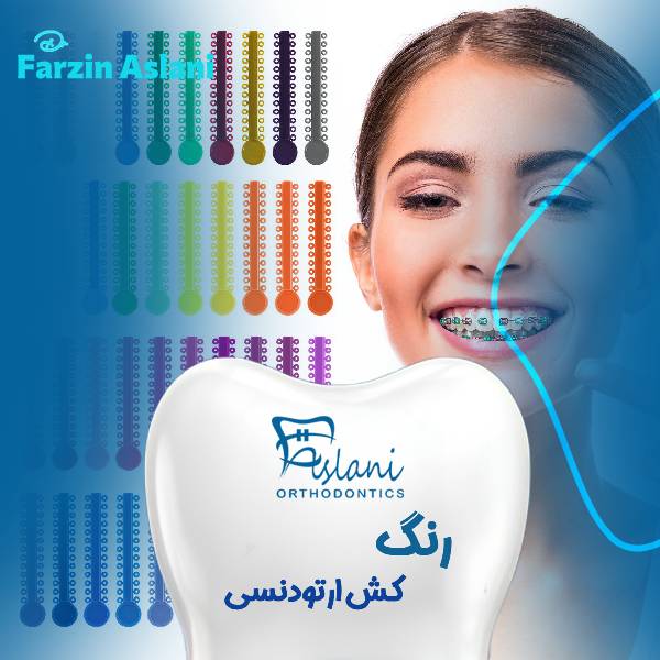 بهترین رنگ کش ارتودنسی