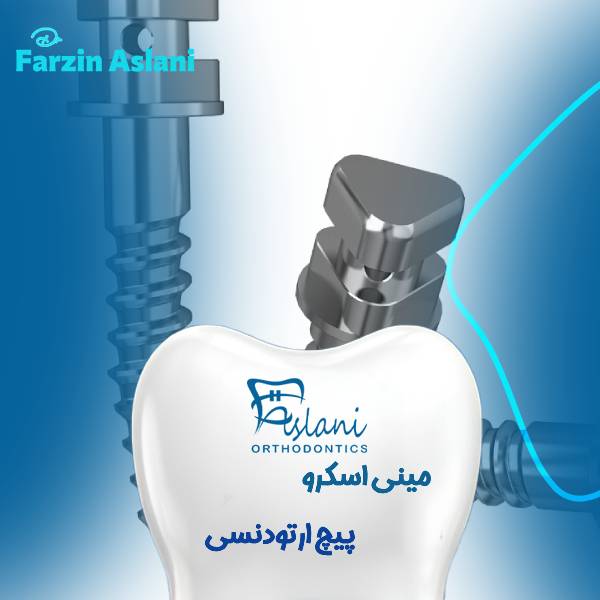 عکس پیچ مینی اسکرو