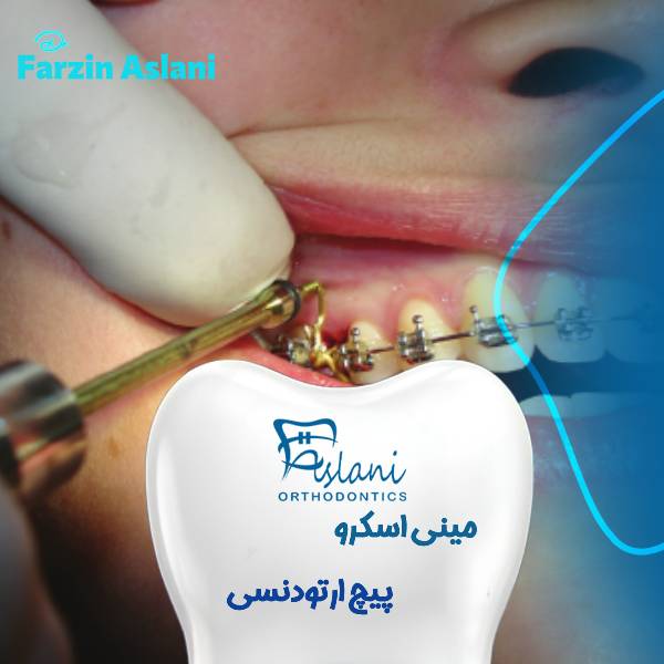 عکس پیچ ارتودنسی