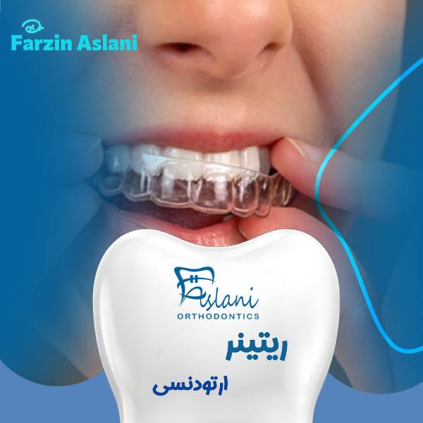 عکس ریتینر ارتودنسی
