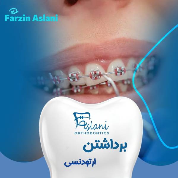 ریمو کردن ارتودنسی