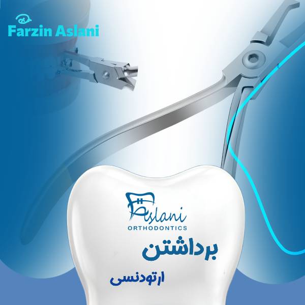 برداشتن براکت ارتودنسی
