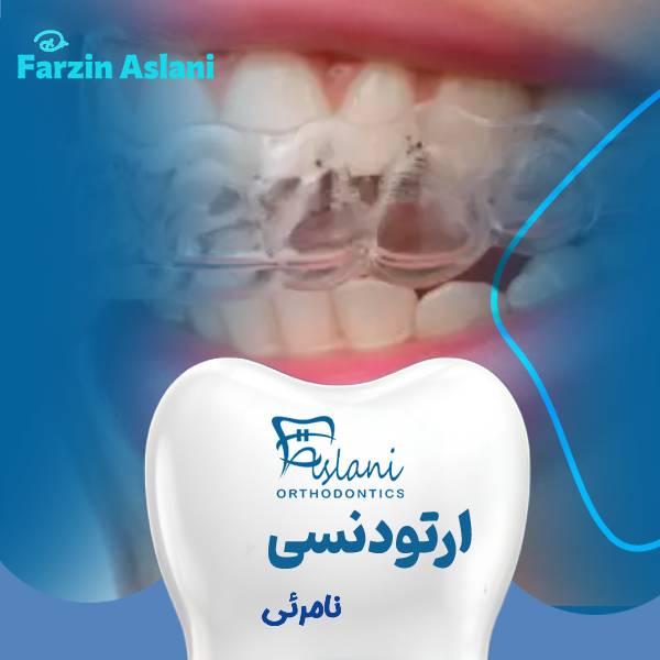 ارتودنسی نامرئی