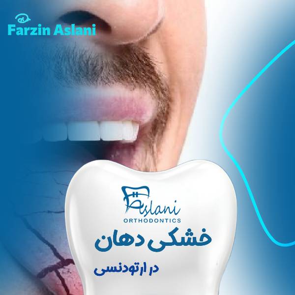 خشکی دهان در ارتودنسی