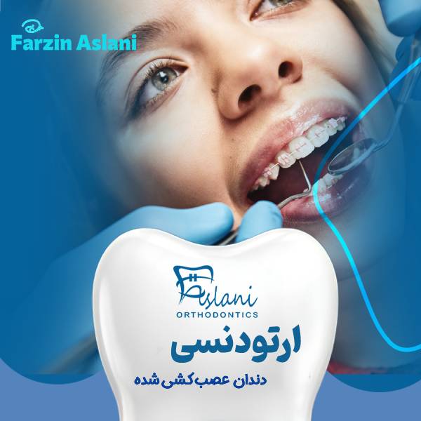 ارتودنسی دندان عصب کشی شده