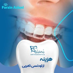 هزینه ارتودنسی نامریی