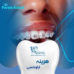 هزینه ارتودنسی