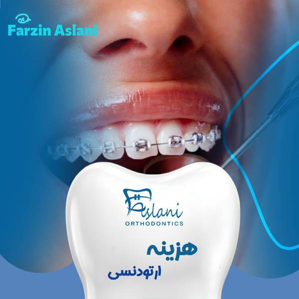 هزینه ارتودنسی