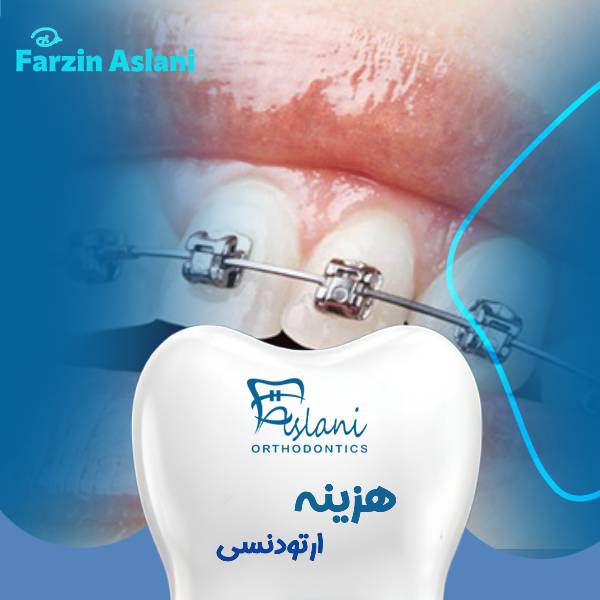 قیمت ارتودنسی