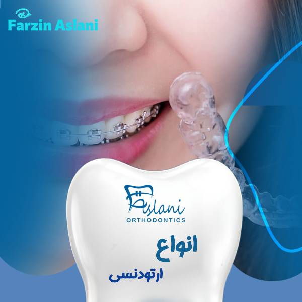 انواع ارتودنسی