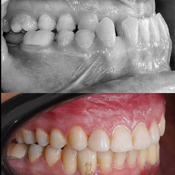 عکس نمونه ارتودنسی